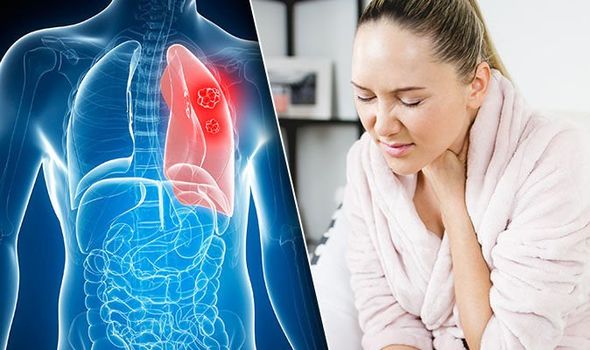 Akciğer Kanserinin İlk 5 Belirtisi Ve Vefat Belirtileri