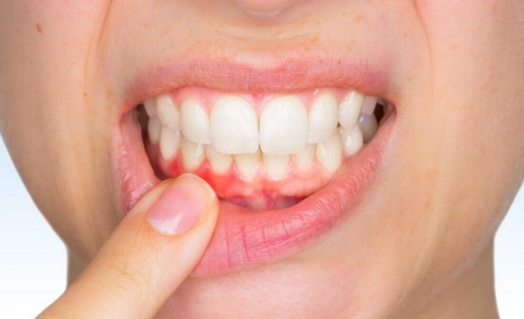 Pandemi yarıyılı noksan kalan diş rehabilitasyonları genel sıhhati nasıl etkiliyor aman dikkat!
